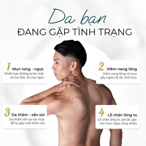 Xịt Hỗ Trợ Giảm Mụn Lưng Oriskin Vicenta Body Mist cho nam
