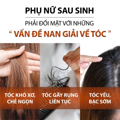 Dầu Gội Bồ Kết Cô Đặc Milaganics 30ml