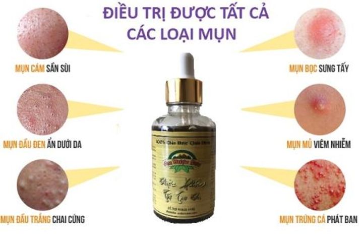 Serum và Bột Rửa Mặt An Dược Sơn - Chiết Xuất Tự Nhiên, Hỗ Trợ Làm Sạch Da Mụn, Phục Hồi Làn Da Sáng Mịn, Thích Hợp Mọi Loại Da
