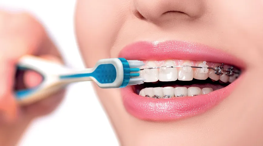 Bàn chải cho người niềng răng Pro Ortho Thụy sĩ chuyên dụng