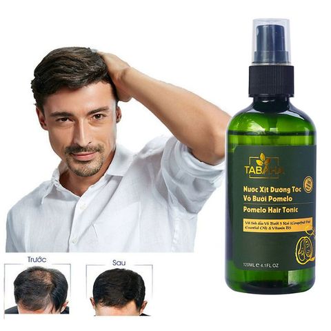 Xịt mọc tóc nhanh tinh dầu vỏ bưởi dành cho Nam bị rụng tóc, tóc thưa