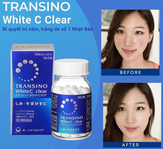 Viên Uống Trắng Da Transino White C - Hỗ Trợ Cải Thiện Nám Tàn Nhang & Sáng Da, Vitamin C Chất Lượng Từ Nhật Bản