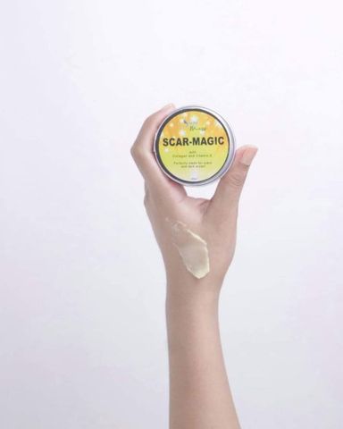 Scarmagic Giúp Làm Mờ Sẹo Và Vết Thâm Nám Hiệu Quả