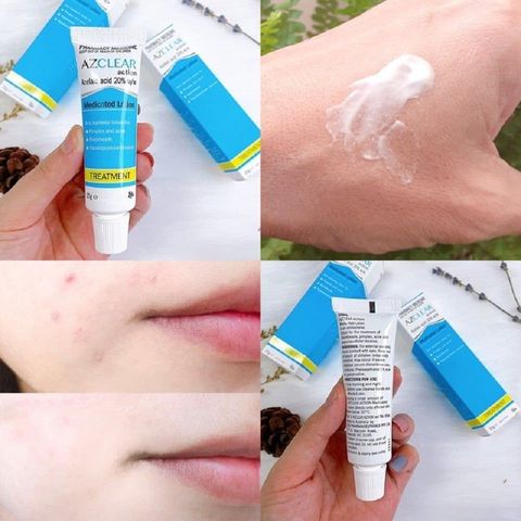 Kem  Azclear Action Medicated Lotion Hỗ Trợ Giảm Mụn, Trắng Da