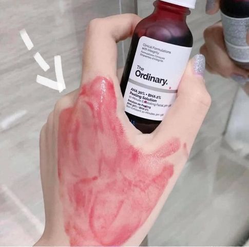 Serum Peel da AHA 30% + BHA 2% Mỹ - The Ordinary