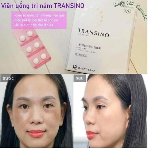 Transino trắng nội địa Nhật Bản chống nám