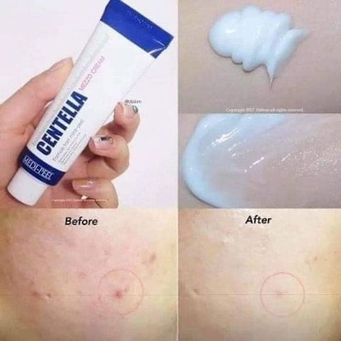 Kem mụn rau má Hàn Quốc Centella - Medipeel
