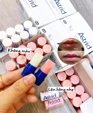 Son Dưỡng Mỡ Hươu Không Màu 4.7g - Astrid, Dưỡng Ẩm Mềm Mại, Phục Hồi Môi Nứt Nẻ, Lip Balm Tự Nhiên từ Cộng Hòa Séc