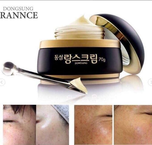 Kem Dongsung Rannce 70ml - Kem Trị Nám và Dưỡng Trắng Da An Toàn, Thích Hợp Mọi Loại Da, Giúp Làm Đều Màu Da Và Ngăn Nám
