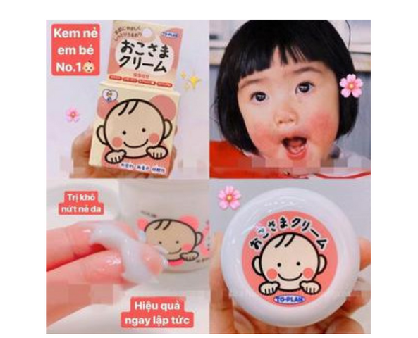 Kem Dưỡng Ẩm Okosama To-Plan Nhật Bản 30g - Kem Nẻ Cho Bé, Giữ Ẩm Và Chống Khô Da Mùa Đông, An Toàn Cho Da Nhạy Cảm