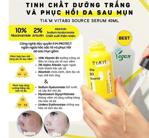 Serum Dưỡng Trắng Da TIA'M Vita B3 - Tinh Chất Phục Hồi Da Sau Mụn, Chống Thâm Mụn, Vitamin B3 10%, Alpha Arbutin 2% - 40ml Hàn Quốc