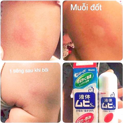 Lăn Bôi Muỗi và Côn Trùng Đốt Muhi Chim Cánh Cụt 50ml - Giảm Ngứa, Sưng Hiệu Quả, An Toàn Cho Trẻ Em Nhật Bản