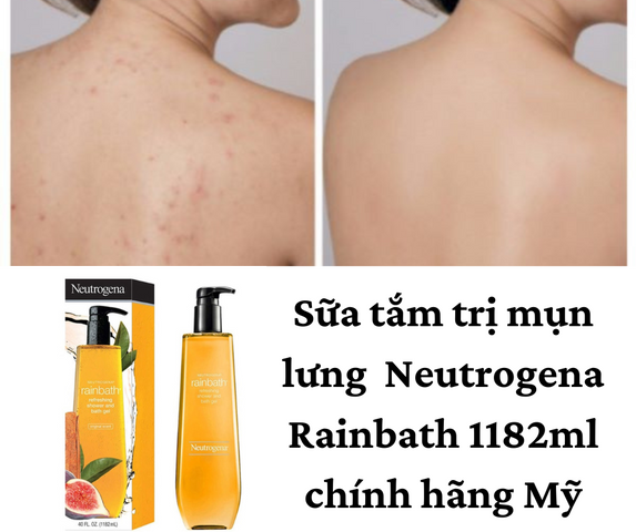 Sữa Tắm Dưỡng Ẩm Neutrogena Rainbath 1182ml - Giảm Mụn Lưng, Hương Trái Cây Tươi Mát, Sạch Da Không Gây Kích Ứng