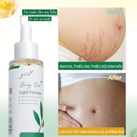 Dầu Dưỡng Da Giảm Rạn Mờ Sẹo Thấm Nhanh GUO Body Light Oil Formula (50ml/150ml)