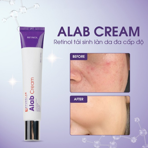 Kem Dưỡng Ẩm Retinol Tái Sinh Làn Da Kyung Lab Alab Cream 30ml - Chống Lão Hóa, Cấp Ẩm, Se Khít Lỗ Chân Lông, Dưỡng Trắng Da