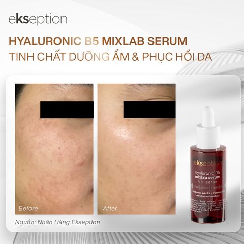 Serum phục hồi và làm dịu da Ekseption hyaluronic B5 Mixlab 75ml