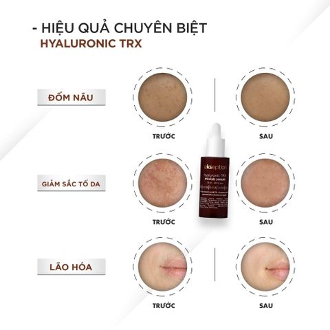 Serum cho da sạm nám Ekseption Hyaluronic TRX Mixlab 75ml