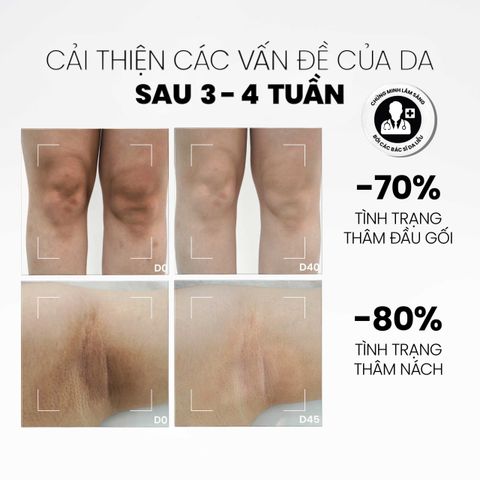 Sữa Dưỡng Thể Sáng Da Mờ Thâm MD Care 200ml - Giúp Làm Sáng Da và Giảm Vết Thâm Tối Ưu, Dưỡng Ẩm Mềm Mại Da