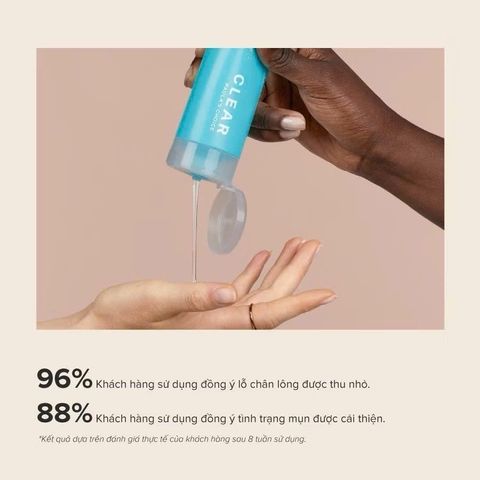 Sữa Rửa Mặt Ngừa Mụn Paula's Choice Clear Pore 177ml - Gel Làm Sạch Da Dầu, Se Lỗ Chân Lông, Phù Hợp Mọi Loại Da