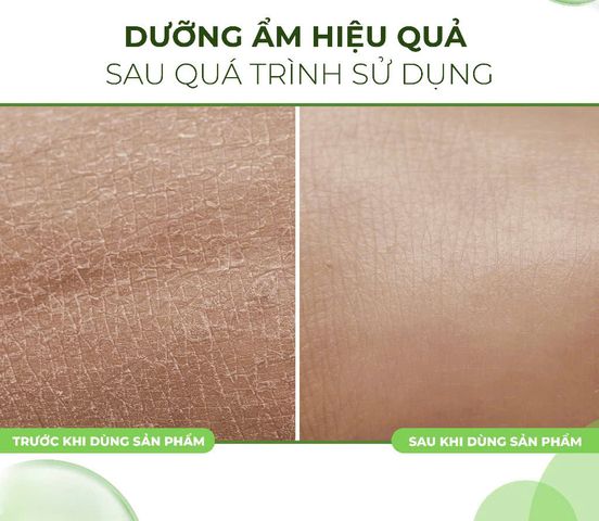 Xà Phòng Dưỡng Ẩm Mềm Mịn Da Fixderma Moisturizing Bar 100g