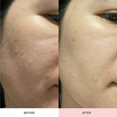 Tinh Chất Candid Retinol 0.5 - Serum Giảm Nếp Nhăn, Căng Bóng Da, Cải Thiện Độ Đàn Hồi, Dưỡng Da Sáng Khỏe 30ml