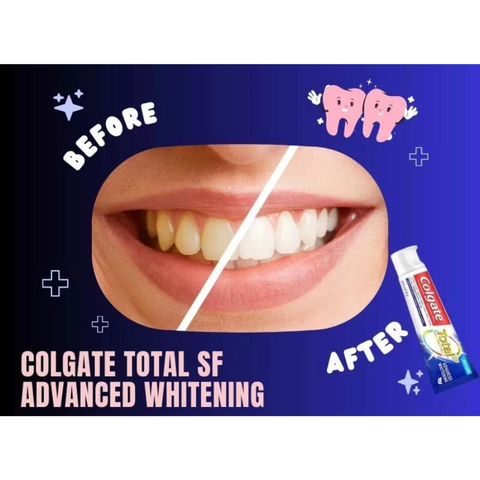 Kem Đánh Răng Colgate Total Advanced Whitening 181g Mỹ, Kem Đánh Răng Colgate Mỹ