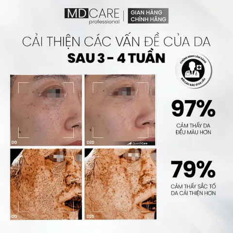 Serum MD CARE VitaC-Arbutin - Serum Dưỡng Sáng Da Chống Lão Hoá 30ml - Giảm Thâm, Đều Màu Da, Kích Thích Collagen