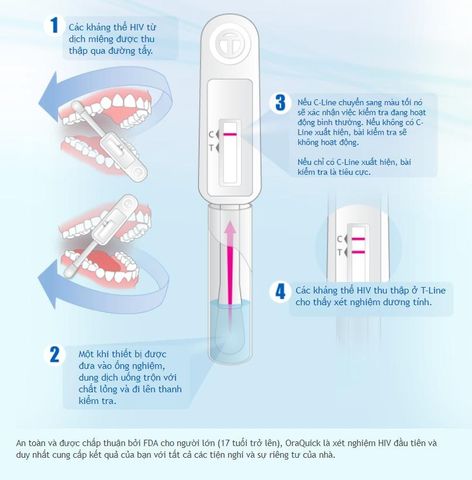 Bộ test xét nghiệm HIV bằng dịch miệng - OraQuick HIV không cần lấy máu