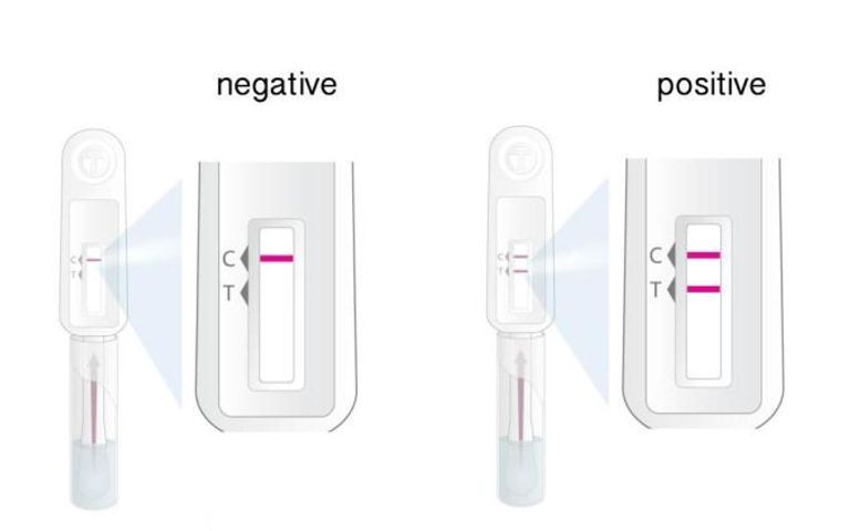 Bộ test xét nghiệm HIV bằng dịch miệng - OraQuick HIV không cần lấy máu
