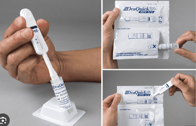 Bộ test xét nghiệm HIV bằng dịch miệng - OraQuick HIV không cần lấy máu