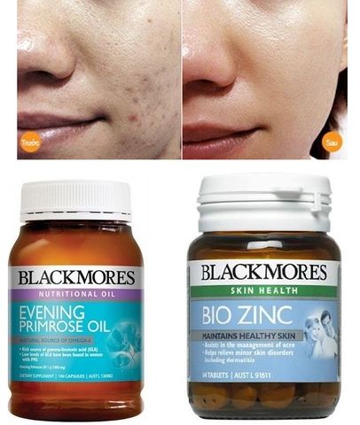 Viên Uống Blackmores Bio Zinc Tự Nhiên 168 Viên - Bổ Sung Kẽm Cho Sức Khỏe Da, Nam Giới và Miễn Dịch