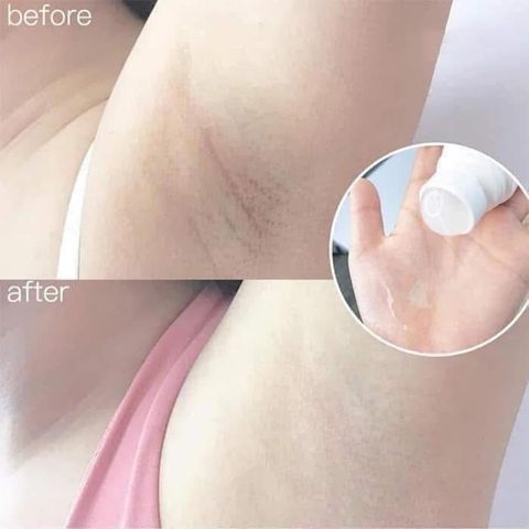 Lăn Khử Mùi Kwangdong Hàn Quốc 30ml - Khử Mùi Hiệu Quả, Ngăn Mồ Hôi Đến 72 Giờ, Sản Phẩm Đa Năng Cho Nách, Tay, Chân