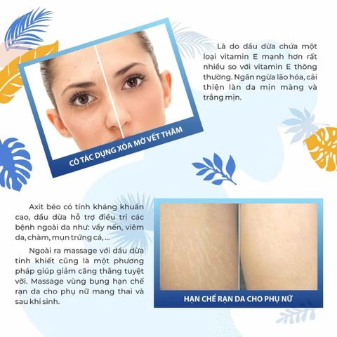 Dầu Dừa Tinh Khiết Vietcoco 130ml - Dưỡng Da, Tóc, Tẩy Trang, Chăm Sóc Đặc Biệt Từ Thiên Nhiên, 100% Nguyên Chất, Không Chất Bảo Quản