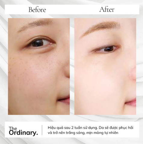 Kem Dưỡng Sáng Thâm Nám Da The Ordinary Vitamin C Suspension 30% In Silicone - Hiệu Quả Làm Sáng Da và Giảm Thâm Nám Tự Nhiên