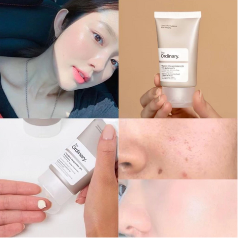 Kem Dưỡng Sáng Thâm Nám Da The Ordinary Vitamin C Suspension 30% In Silicone - Hiệu Quả Làm Sáng Da và Giảm Thâm Nám Tự Nhiên