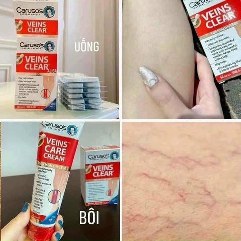 Kem bôi/Viên uống cải thiện suy giãn tĩnh mạch Caruso's Veins Care