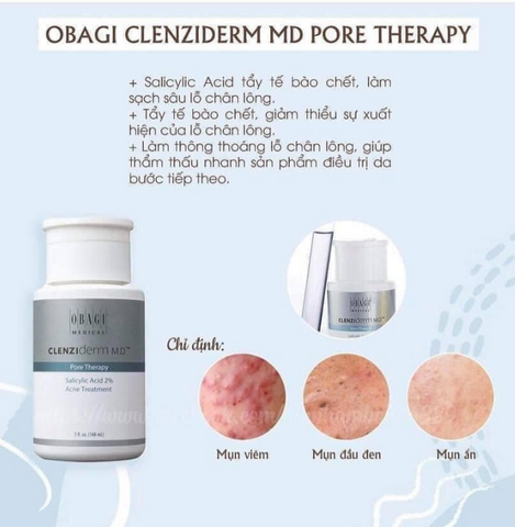Nước Hoa Hồng Làm Sạch Sâu giảm Mụn Toner Bha Obagi 148ml