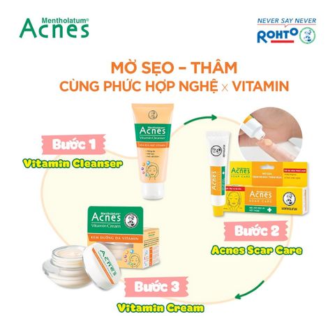 Kem Dưỡng Acnes Vitamin Sáng Da 40g - Kem Mờ Sẹo Thâm, Phục Hồi Da Sau Mụn, Dưỡng Ẩm, Giúp Da Sáng Mịn, Thương Hiệu Nhật Bản