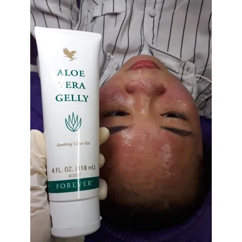 Gel Dưỡng Da Forever Aloe Vera Gelly 118ml - Giảm Mụn, Sẹo, Chăm Sóc Da Nhạy Cảm, Phục Hồi Da Hư Tổn