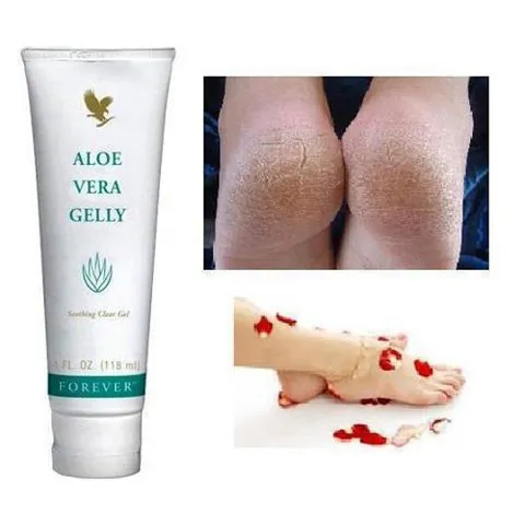 Gel Dưỡng Da Forever Aloe Vera Gelly 118ml - Giảm Mụn, Sẹo, Chăm Sóc Da Nhạy Cảm, Phục Hồi Da Hư Tổn