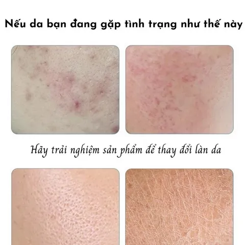 Mặt Nạ Dưỡng Da Chiết Xuất Thiên Nhiên 25g - Cấp Ẩm, Dưỡng Trắng, Giảm Mụn, Mờ Thâm Căng Bóng, Thư Giãn Da Chất Lượng Cao