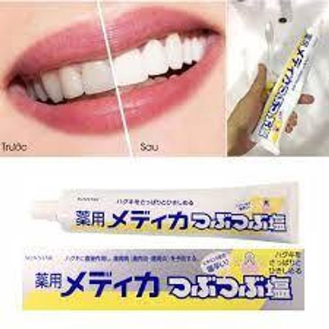 Kem Đánh Răng Muối SunStar Nhật 170g - Sạch Khuẩn, Ngừa Sâu Răng, Bảo Vệ Nướu, Hơi Thở Tươi Mát, Chăm Sóc Răng Miệng Hiệu Quả