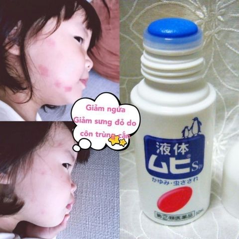 Lăn Bôi Vết Côn Trùng Cắn Muhi 50ml - Giảm Ngứa, Sưng Tấy, Dễ Dàng Mang Theo, An Toàn Cho Trẻ Em