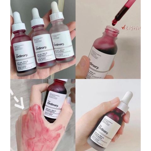 Serum Tẩy Tế Bào Chết Hóa Học The Ordinary AHA 30% + BHA 2% - Giúp Làm Sáng Da, Giảm Mụn, Làm Đều Màu Da 30ml