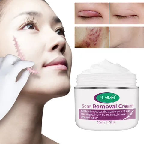 Kem Làm Mờ Sẹo OUHOE - Giảm Thâm, Xóa Sẹo Cũ, Côn Trùng Cắn, Sẹo Lồi - Chăm Sóc Da Tất Cả Các Loại Da, 50g
