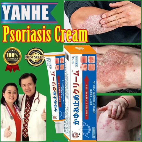 Kem Bôi Nấm Nhật Bản - Chống Viêm Da, Hắc Lào, Tổ Đĩa, Chàm, Nấm, Dị Ứng - Chăm Sóc Cơ Thể Hiệu Quả