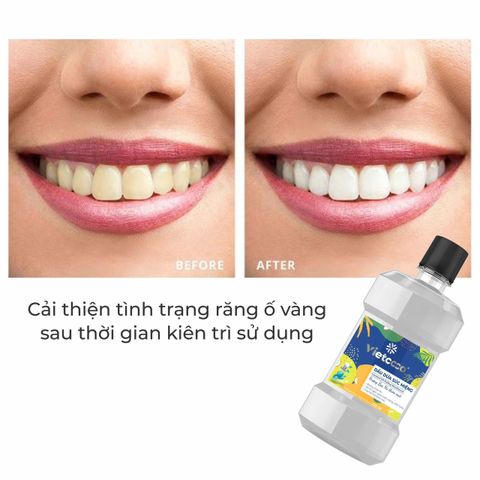 Dầu Dừa Súc Miệng Vietcoco Hương Bạc Hà 225ml - Không Cồn, Diệt Khuẩn, Hỗ Trợ Sức Khỏe Răng Miệng