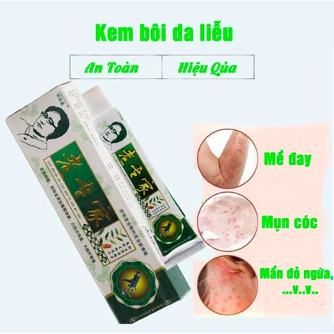 Kem Bôi Da Chuyên Ngành Điều Trị Nấm Ngứa, Á Sừng, Eczema - Kem Đông Y Trung Quốc Hiệu Quả Tại Nhà