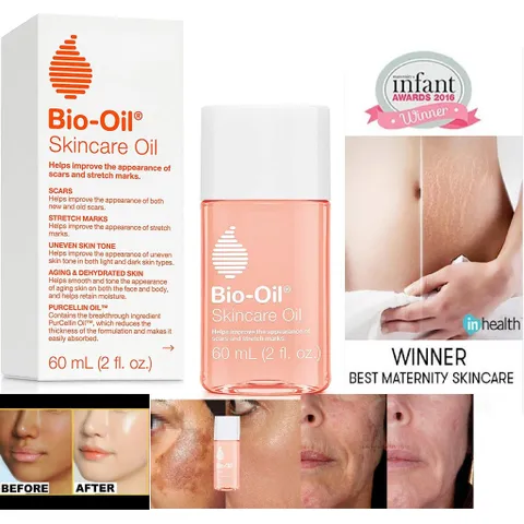 (Hàng úc)  Tinh Dầu Bio Oil Mờ Sẹo Và Giảm Rạn Da của Úc