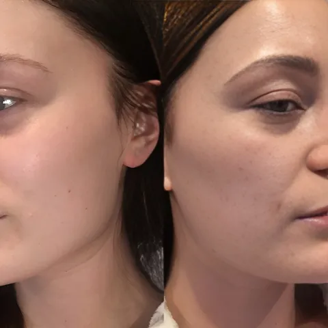 Combo Sample Alpha-H Essential Skin Perfecting Moisturiser SPF15 5ml & Liquid Gold Exfoliant - Bộ Dưỡng Da Hoàn Hảo cho Làn Da Tươi Sáng